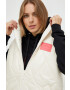 Armani Exchange Елек с две лица - Pepit.bg