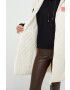 Armani Exchange Елек с две лица - Pepit.bg