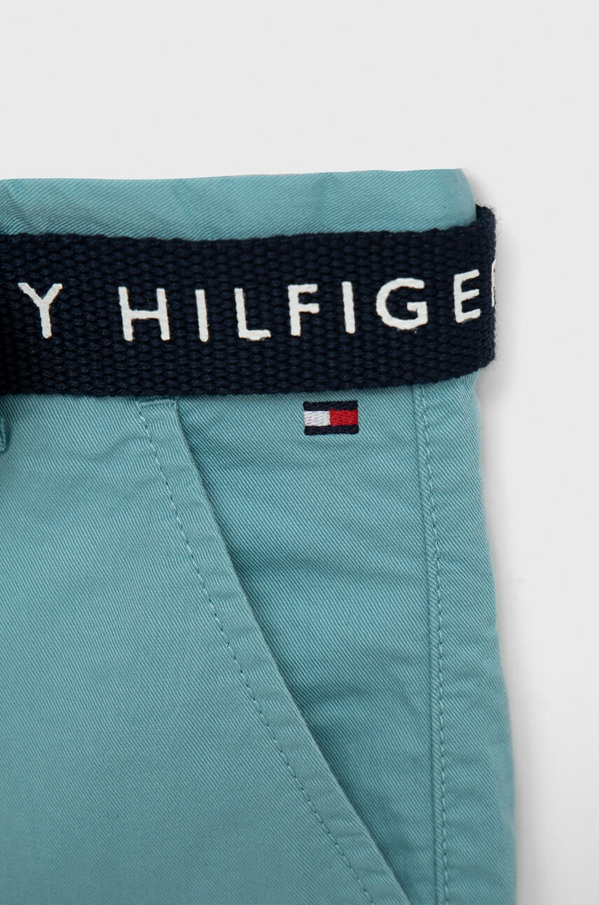 Tommy Hilfiger Детски къси панталони с регулируема талия - Pepit.bg