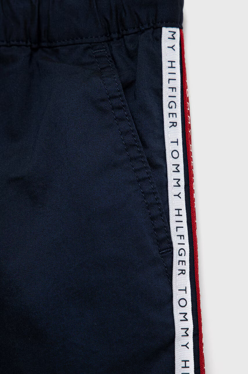 Tommy Hilfiger Детски къси панталони - Pepit.bg