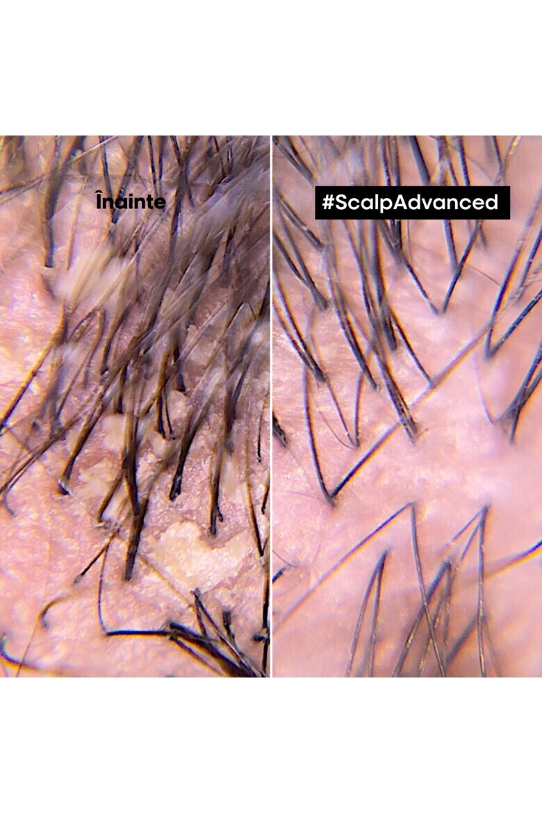 LOreal Professionnel Шампоан Serie Expert - 300 мл - Pepit.bg