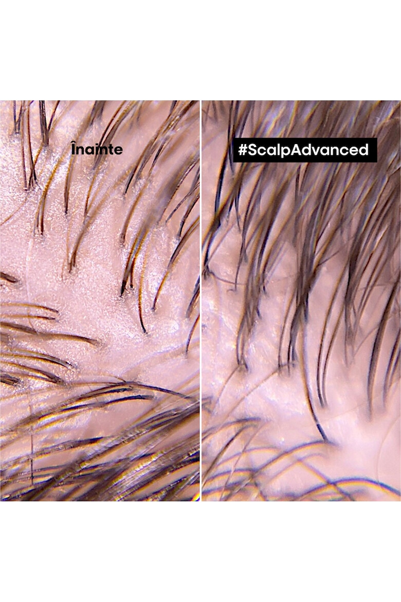 L'Oreal Professionnel Шампоан Serie Expert 300 мл - Pepit.bg